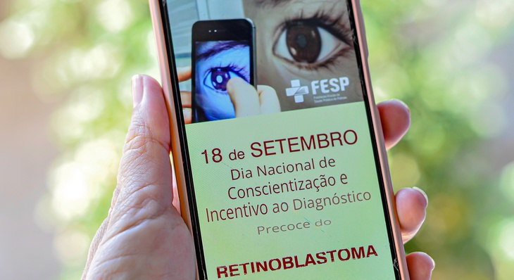 Residentes em oftalmologia da Fesp gravam vídeo sobre retinoblastoma
