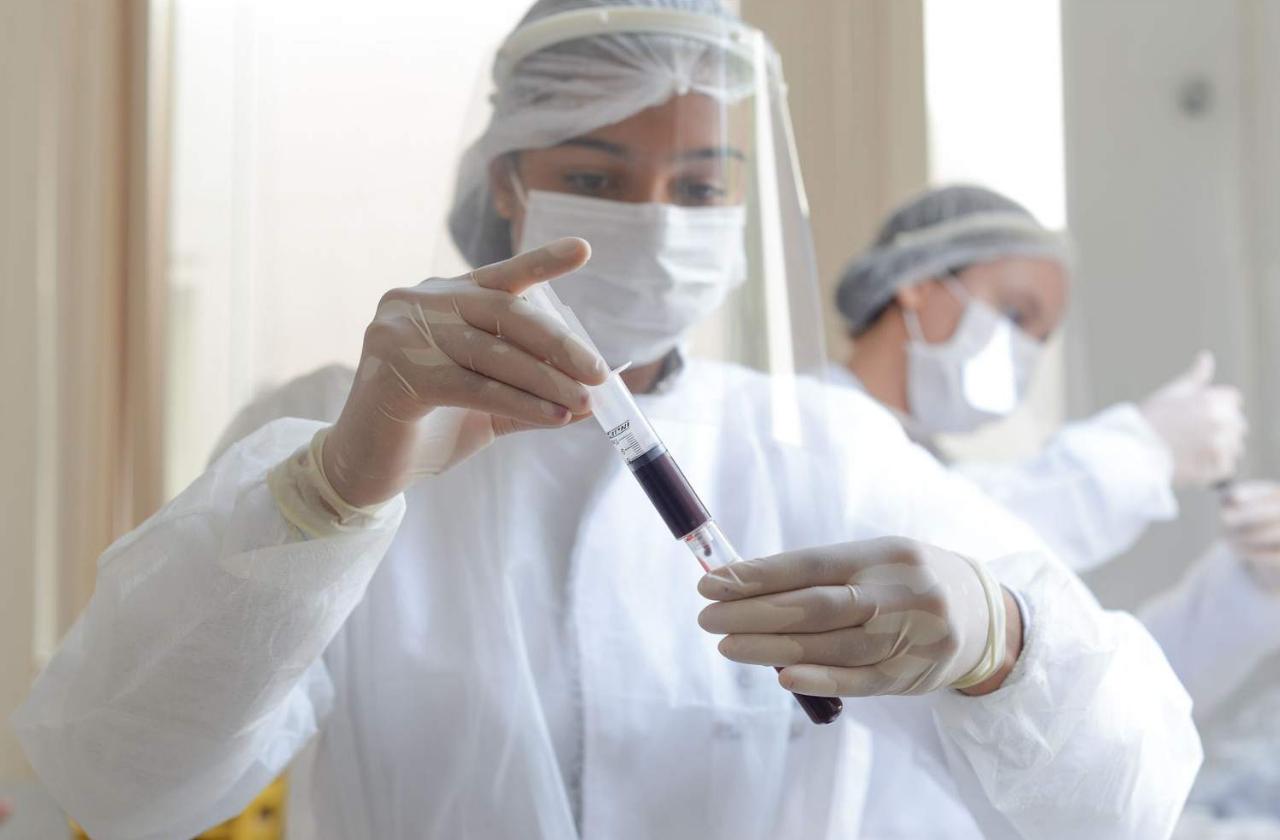 Palmas chega a 100ª edição do Boletim Epidemiológico neste sábado, 27, e Semus destaca ações de combate a Covid-19