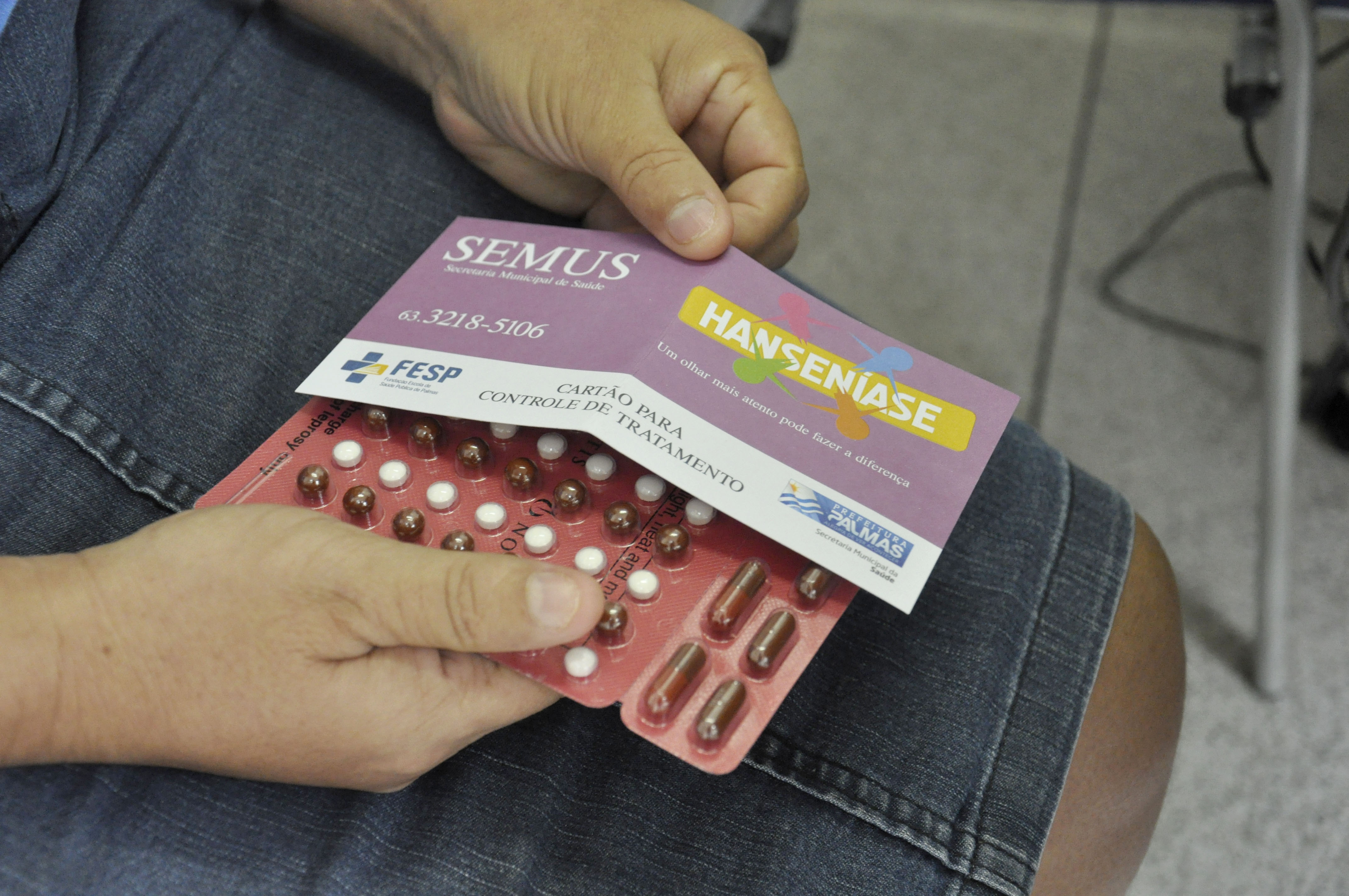 Curso ‘Ações de Controle em Hanseníase’ recebe segunda turma nesta quinta-feira, 05