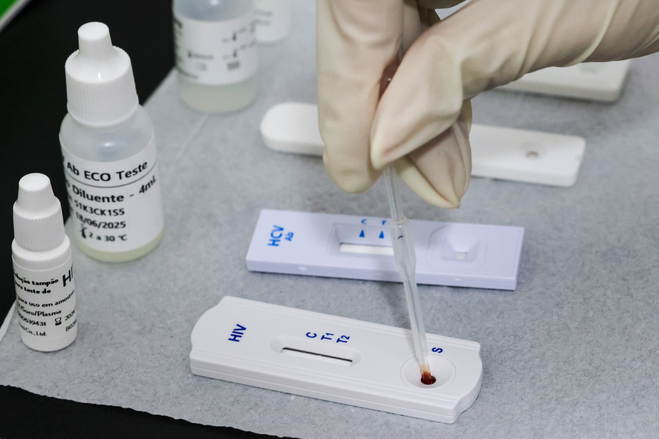USF Arno 61 promove ação noturna para conscientização e detecção de Infecções Sexualmente Transmissíveis