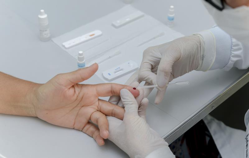 Semus oferece exames para detecção de hepatites virais