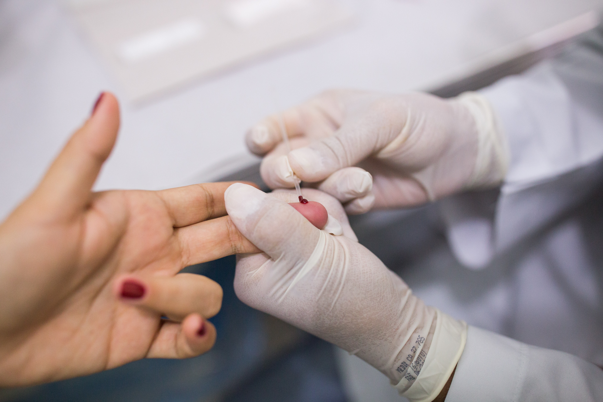 Teste rápido é fundamental para diagnóstico precoce e tratamento adequado de HIV/Aids, hepatite e sífilis