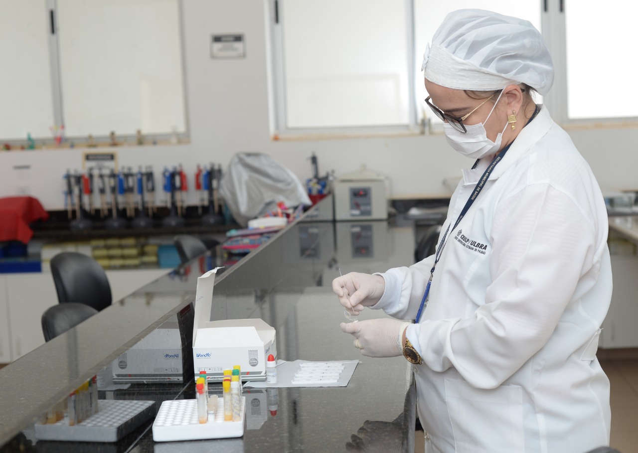 Em Palmas já foram realizados 1.860 testes para a Covid-19